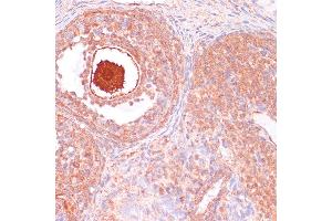 Immunohistochemistry (IHC) image for anti-Cell Division Cycle 20 Homolog (S. Cerevisiae) (CDC20) (AA 1-270) antibody (ABIN7266246)