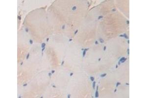 Immunohistochemistry (IHC) image for anti-Acetylcholinesterase (AChE) (AA 123-334) antibody (ABIN1174625)