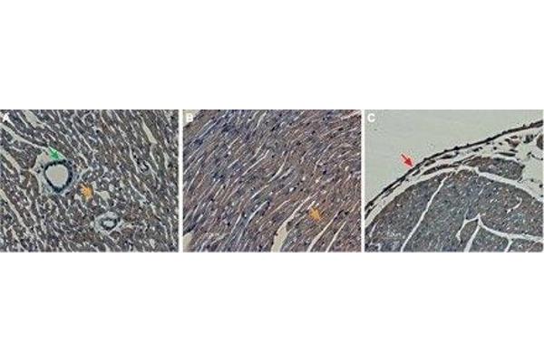 KCNH2 抗体  (Extracellular)