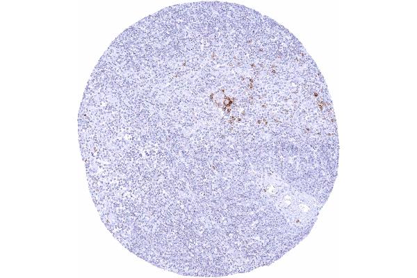 Recombinant IgD 抗体