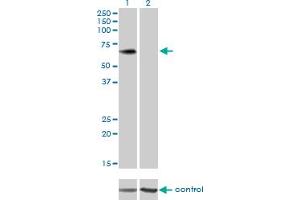 Western blot analysis of PLXDC1 over-expressed 293 cell line, cotransfected with PLXDC1 Validated Chimera RNAi (Lane 2) or non-transfected control (Lane 1). (PLXDC1 抗体  (AA 313-421))
