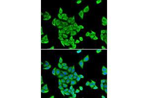 Immunofluorescence (IF) image for anti-Cytokine Induced Apoptosis Inhibitor 1 (CIAPIN1) antibody (ABIN1980352) (CIAPIN1 抗体)