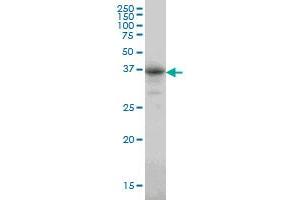 CA8 monoclonal antibody (M01), clone 1F7 Western Blot analysis of CA8 expression in A-549 . (CA8 抗体  (AA 40-139))