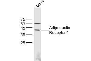 Mouse bone lysates probed with Adiponectin Receptor 1 Polyclonal Antibody, Unconjugated  at 1:300 dilution and 4˚C overnight incubation. (Adiponectin Receptor 1 抗体  (AA 241-270))