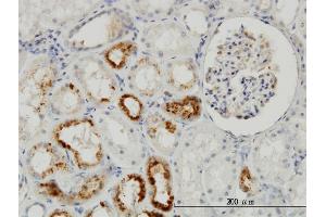 Immunoperoxidase of monoclonal antibody to TIMP2 on formalin-fixed paraffin-embedded human kidney. (TIMP2 抗体  (AA 27-220))