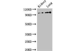 Western Blot Positive WB detected in: Mouse kidney tissue, Rat lung tissue All lanes: VAV3 antibody at 2. (VAV3 抗体  (AA 562-674))