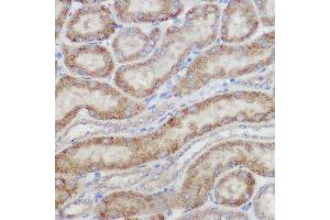 Immunohistochemistry (IHC) image for anti-NADH Dehydrogenase (Ubiquinone) 1 beta Subcomplex, 8, 19kDa (NDUFB8) antibody (ABIN7268814)