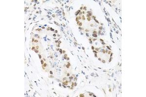 Immunohistochemistry (Paraffin-embedded Sections) (IHC (p)) image for anti-Karyopherin (Importin) alpha 4 (KPNA4) (AA 1-240) antibody (ABIN3015855)
