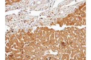IHC-P Image Immunohistochemical analysis of paraffin-embedded human liver, using FDFT1, antibody at 1:100 dilution. (FDFT1 抗体)