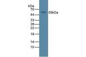 Detection of ErbB2 in Rat Liver Tissue using Polyclonal Antibody to Receptor Tyrosine Protein Kinase erbB-2 (ErbB2) (ErbB2/Her2 抗体  (AA 377-579))