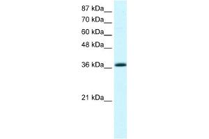 WB Suggested Anti-KLF1 Antibody Titration:  2. (KLF1 抗体  (Middle Region))