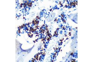 Immunohistochemistry of paraffin-embedded mouse bone marrow using S100 Rabbit mAb (ABIN7270128) at dilution of 1:100 (40x lens). (S100A8 抗体)