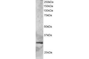 Western Blotting (WB) image for anti-SYF2 Homolog, RNA Splicing Factor (SYF2) antibody (ABIN5920069) (SYF2 抗体)
