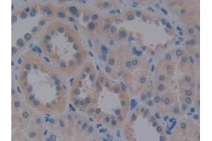 Detection of VLDLR in Human Kidney Tissue using Polyclonal Antibody to Very Low Density Lipoprotein Receptor (VLDLR) (VLDLR 抗体  (AA 418-722))