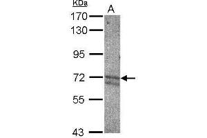 WB Image Sample (30 ug of whole cell lysate) A: NT2D1 7. (KEAP1 抗体  (C-Term))