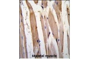 Formalin-fixed and paraffin-embedded human skeletal muscle tissue reacted with VINC antibody (N-term) , which was peroxidase-conjugated to the secondary antibody, followed by DAB staining. (Vinculin 抗体  (N-Term))