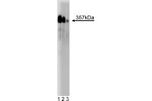 Western Blotting (WB) image for anti-Centromere Protein F (CENPF) (AA 209-381) antibody (ABIN968167)