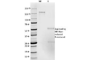 SDS-PAGE Analysis Purified CD50 Mouse Monoclonal Antibody (186-2G9). (ICAM-3/CD50 抗体)