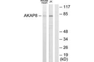 Western blot analysis of extracts from mouse heart/Jurkat cells, using AKAP8 Antibody.