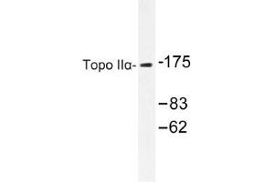 Image no. 2 for anti-Topoisomerase (DNA) II alpha 170kDa (TOP2A) antibody (ABIN317662)