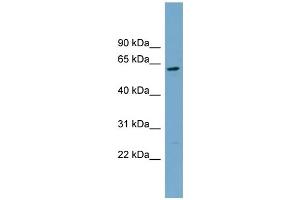 WB Suggested Anti-CNDP2 Antibody Titration: 0. (CNDP2 抗体  (Middle Region))