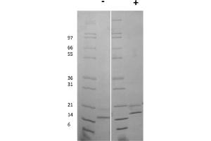 SDS-PAGE of Mouse Fibroblast Growth Factor-9 Recombinant Protein SDS-PAGE of Mouse Fibroblast Growth Factor-9 Recombinant Protein. (FGF9 蛋白)