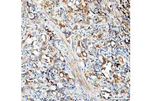 IHC analysis of SEC22B using anti-SEC22B antibody (ABIN7602121).