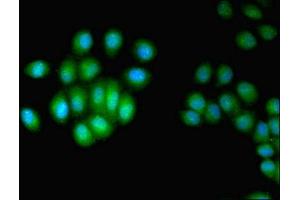 Immunofluorescent analysis of A549 cells using ABIN7147541 at dilution of 1:100 and Alexa Fluor 488-congugated AffiniPure Goat Anti-Rabbit IgG(H+L) (HUS1 抗体  (AA 2-280))