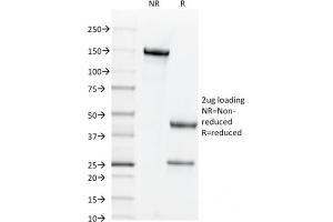 SDS-PAGE Analysis Purified CD44v6 Mouse Monoclonal Antibody (2F10). (CD44 抗体)
