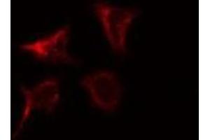 ABIN6276940 staining K562 by IF/ICC. (LIG3 抗体  (Internal Region))
