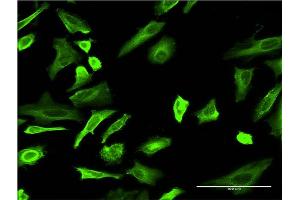 Immunofluorescence of monoclonal antibody to TUBA4A on HeLa cell. (TUBA4A 抗体  (AA 1-448))