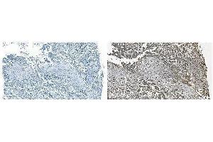 IHC analysis of GRSF1 using anti-GRSF1 antibody (ABIN7599803).