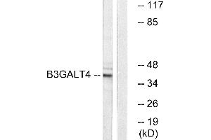 Western blot analysis of extracts from Jurkat cells, using B3GALT4 antibody. (B3GALT4 抗体)