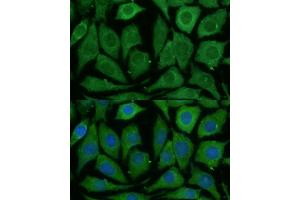 Immunofluorescence analysis of L929 cells using SARDH Polyclonal Antibody (ABIN6128753, ABIN6147379, ABIN6147380 and ABIN6225034) at dilution of 1:100 (40x lens). (SARDH 抗体  (AA 300-560))