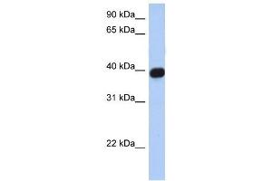 CXCR6 antibody (70R-10500) used at 0. (CXCR6 抗体  (N-Term))