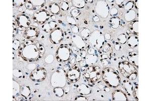 Immunohistochemical staining of paraffin-embedded liver tissue using anti-PLEKmouse monoclonal antibody. (Pleckstrin 抗体)