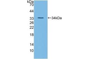 Detection of Recombinant ANGPTL3, Mouse using Polyclonal Antibody to Angiopoietin Like Protein 3 (ANGPTL3) (ANGPTL3 抗体  (AA 22-281))