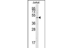 Western blot analysis of anti-G4A Pab 1808c in Jurkat cell line lysates (35 μg/lane). (ATG4A 抗体  (AA 363-392))