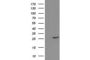 Western Blotting (WB) image for anti-Hydroxyprostaglandin Dehydrogenase 15-(NAD) (HPGD) antibody (ABIN1496364) (HPGD 抗体)