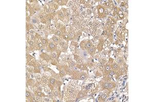 Immunohistochemistry of paraffin-embedded human liver using IL11RA Rabbit mAb (ABIN7267984) at dilution of 1:150 (40x lens). (IL11RA 抗体)