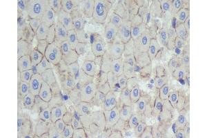 Immunohistochemistry analysis of paraffin-embedded human liver using N-cadherin Polyclonal Antibody at dilution of 1:500. (N-Cadherin 抗体)