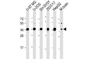 All lanes : Anti-EN1 (Engrailed 1) Antibody (N-term) at 1:2000 dilution Lane 1: U-87 MG whole cell lysate Lane 2: U-2OS whole cell lysate Lane 3: SH-SY5Y whole cell lysate Lane 4: 293T/17 whole cell lysate Lane 5: HepG2 whole cell lysate Lane 6: Mouse brain lysate Lysates/proteins at 20 μg per lane. (EN1 抗体  (N-Term))
