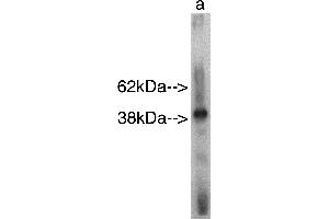 Western blot analysis using Sphingomyelin Synthase r  on recombinant protein Lane A] antibody alone. (SAMD8 抗体)