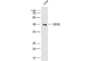 Mouse Liver lysates probed with DDB2 Polyclonal Antibody, Unconjugated  at 1:500 dilution and 4˚C overnight incubation. (DDB2 抗体  (AA 201-300))