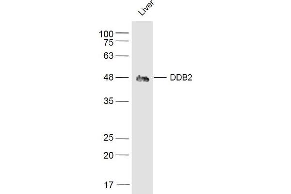 DDB2 抗体  (AA 201-300)