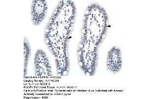 ARP40384 Paraffin Embedded Tissue: Human Intestine Cellular Data: Epithelial cells of intestinal villas Antibody Concentration: 4. (HNRNPA1 抗体  (C-Term))
