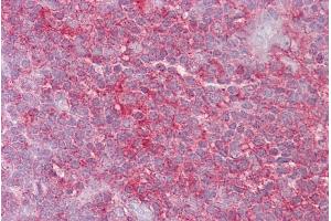 Immunohistochemistry with Thymus tissue at an antibody concentration of 5µg/ml using anti-KIF2A antibody (ARP33902_P050) (KIF2A 抗体  (N-Term))