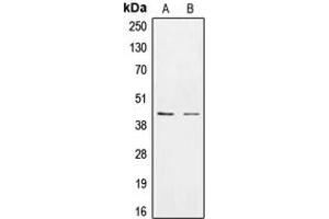 Western blot analysis of CK1 epsilon expression in HEK293T (A), SKBR3 (B) whole cell lysates. (CK1 epsilon 抗体  (Center))