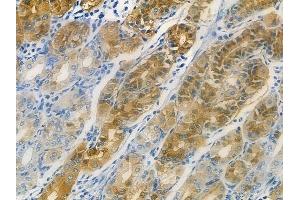 ABIN6261034 and ABIN6273107 at 1/100 staining human normal gastric tissue by IHC-P.