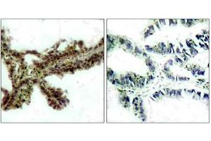 Image no. 1 for anti-V-Akt Murine Thymoma Viral Oncogene Homolog 1 (AKT1) (pThr308) antibody (ABIN196710) (AKT1 抗体  (pThr308))
